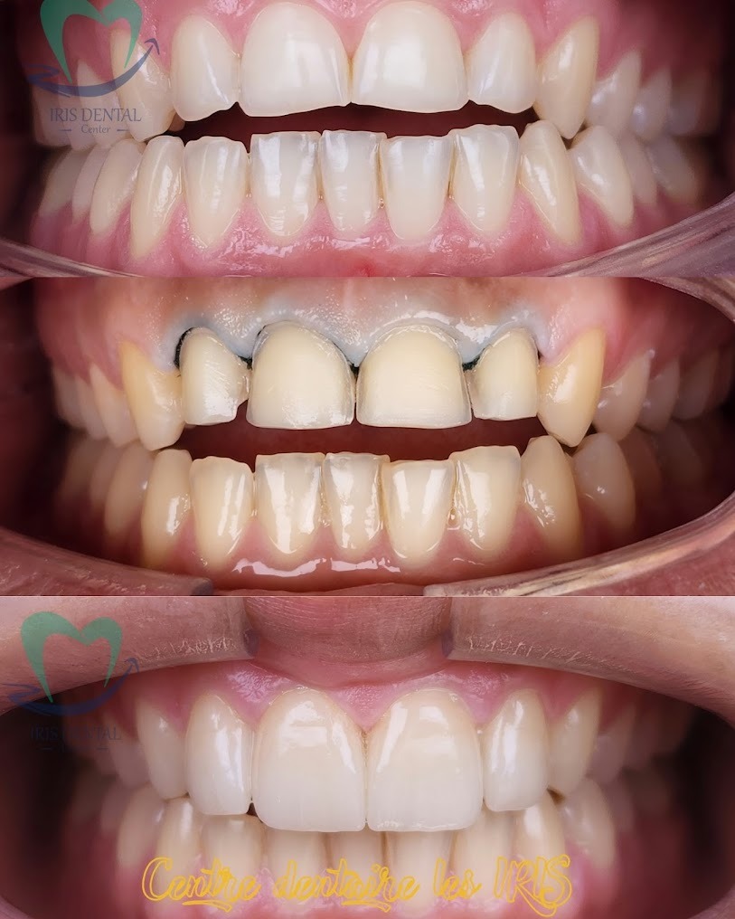 Transformation 1
