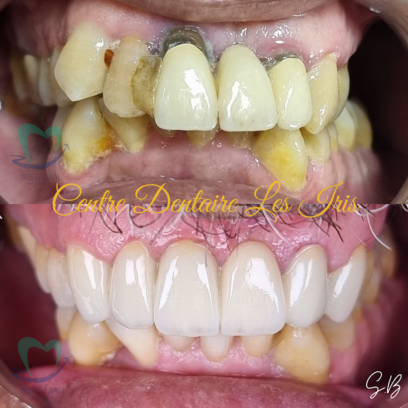 Transformation 2