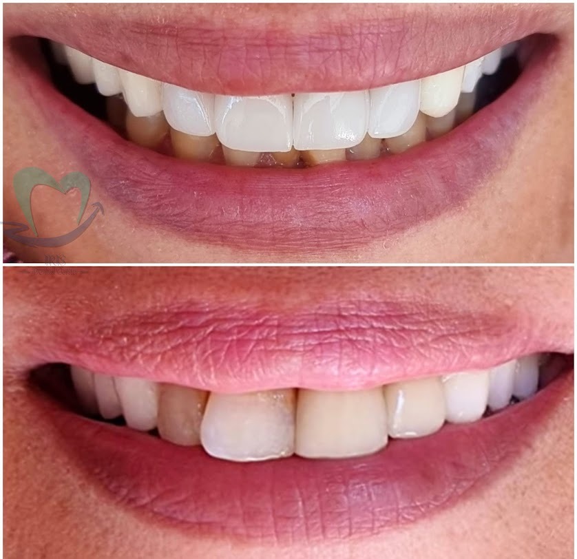 Transformation 3