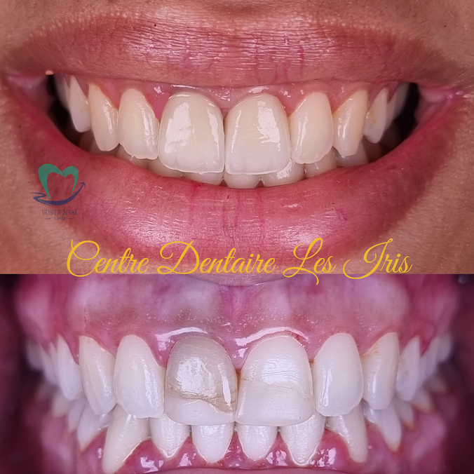 Transformation 5